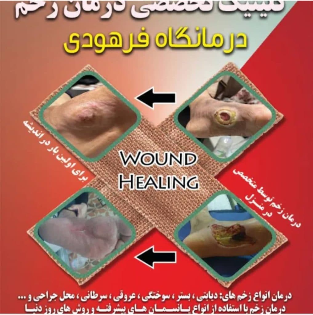 کلینیک زخم اکبری پور در اندیشه