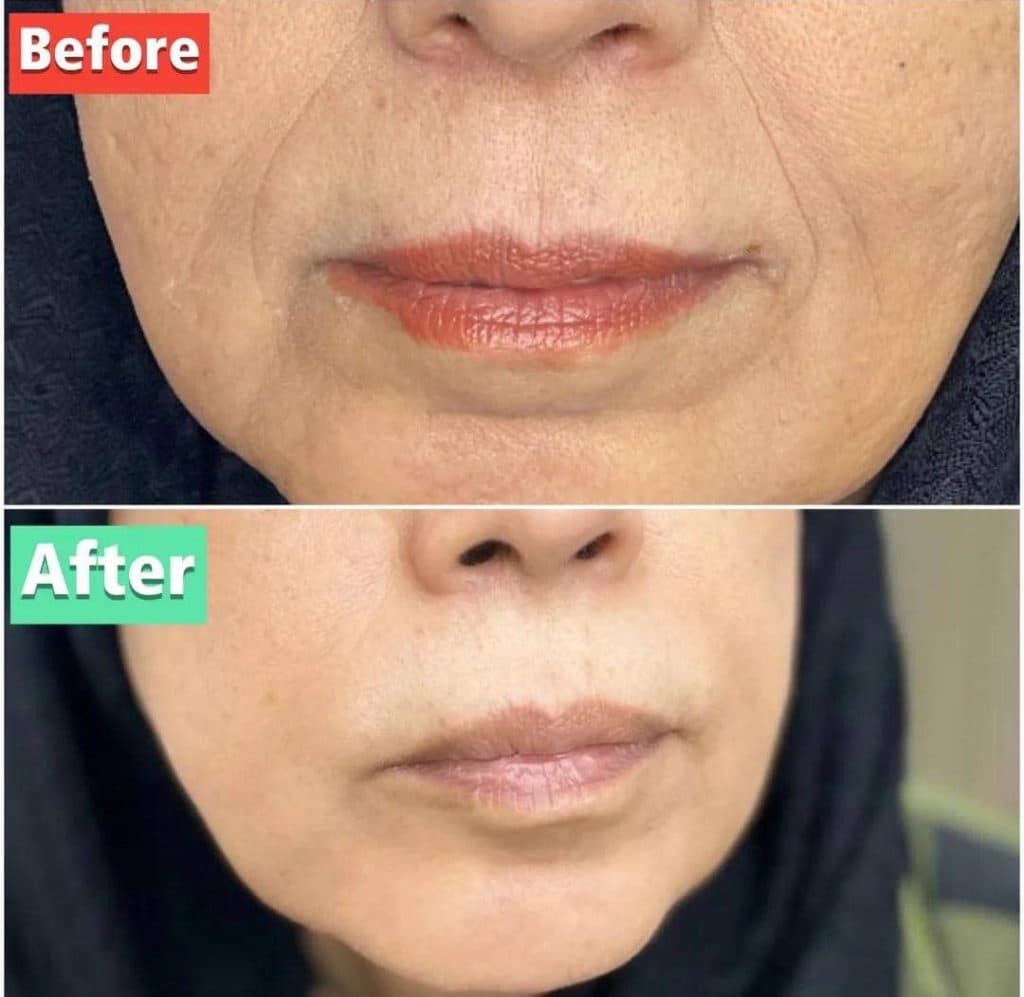 کلینیک زیبایی پوست و مو شاین در مجیدیه تهران