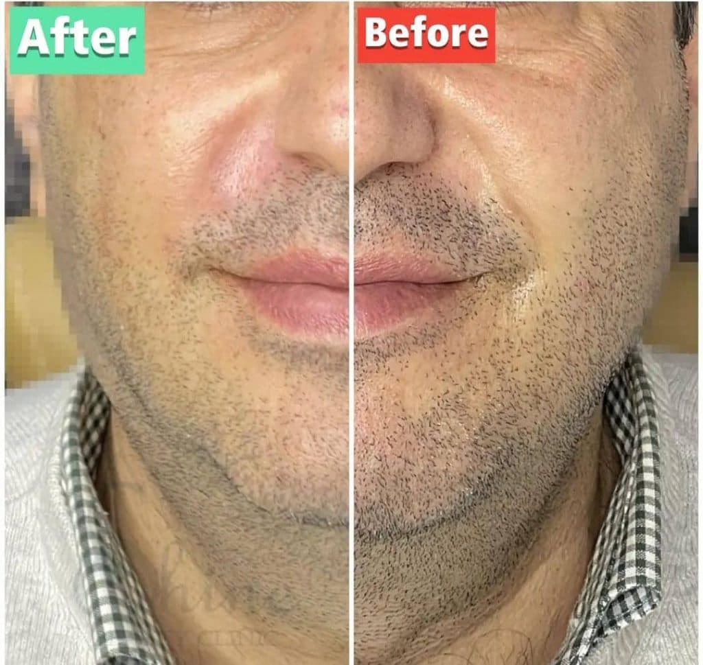 کلینیک زیبایی پوست و مو شاین در مجیدیه تهران