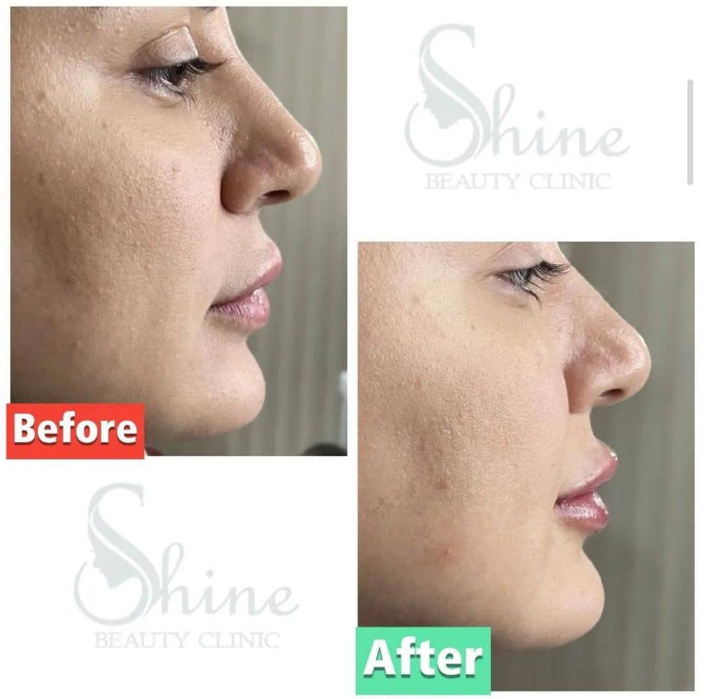 کلینیک زیبایی پوست و مو شاین در مجیدیه تهران