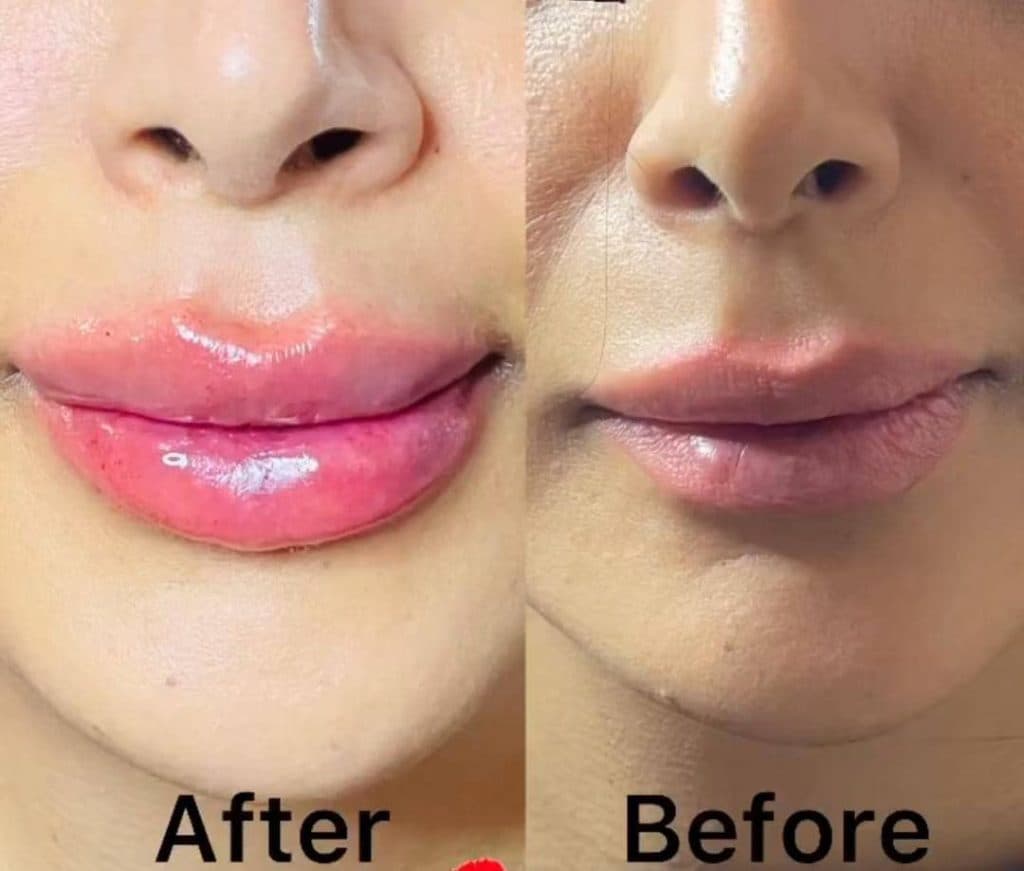 کلینیک زیبایی پوست و مو شاین در مجیدیه تهران