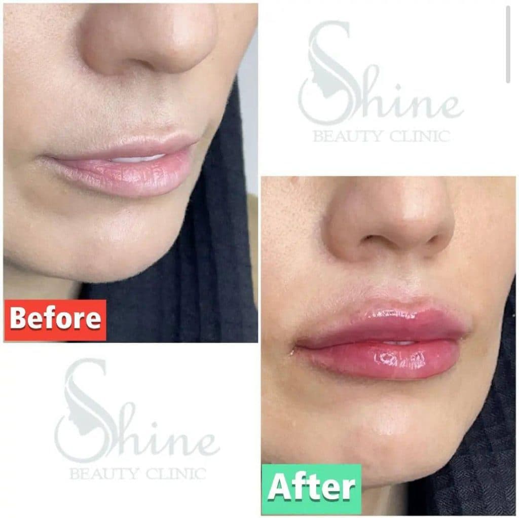 کلینیک زیبایی پوست و مو شاین در مجیدیه تهران