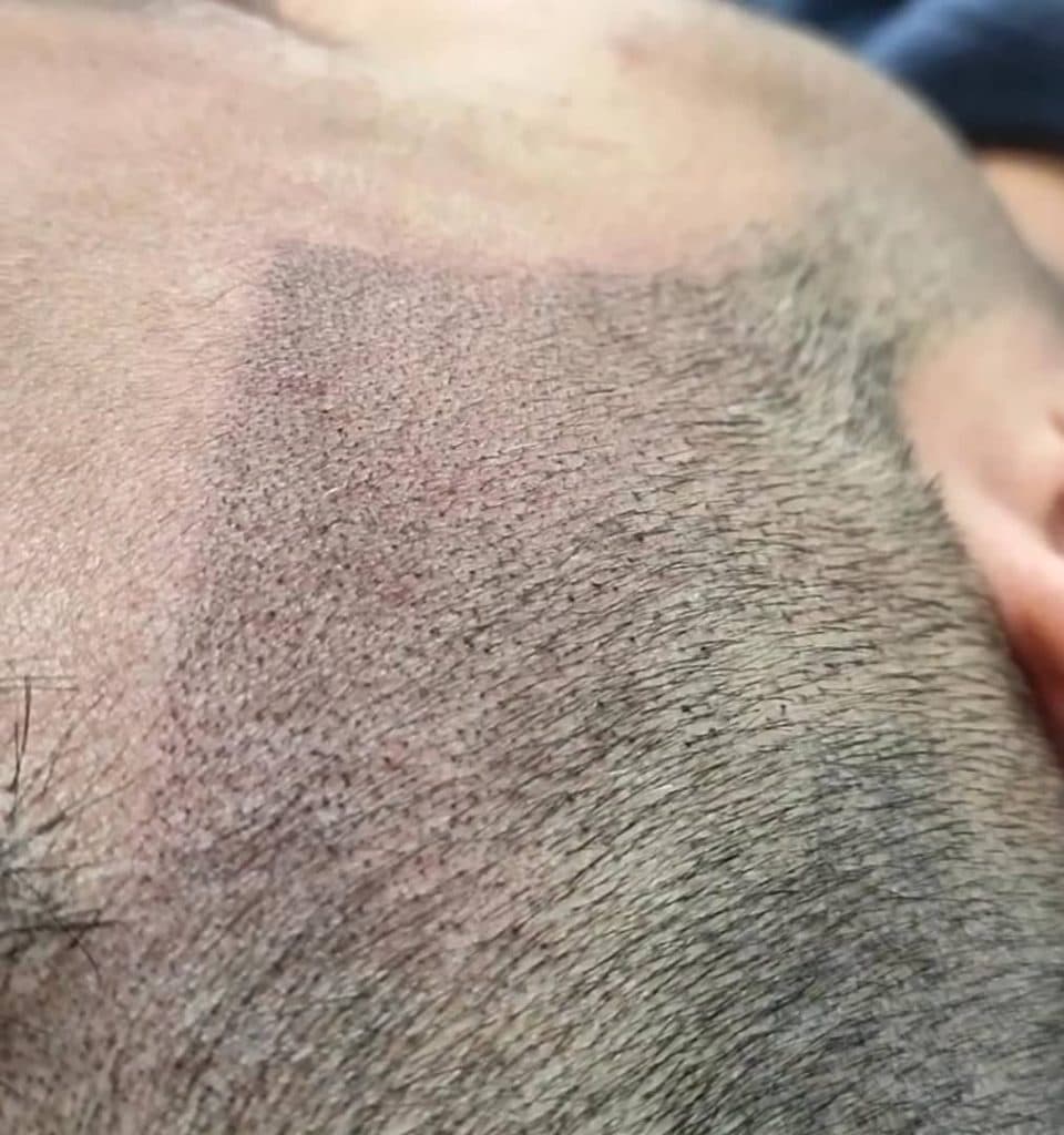 مرکز تخصصی اسکالپ کیان بهبودی در شیراز