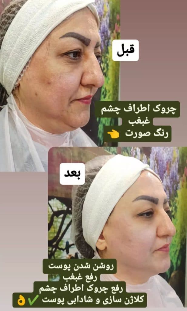 کلینیک زیبایی پوست و مو نهال در تهران