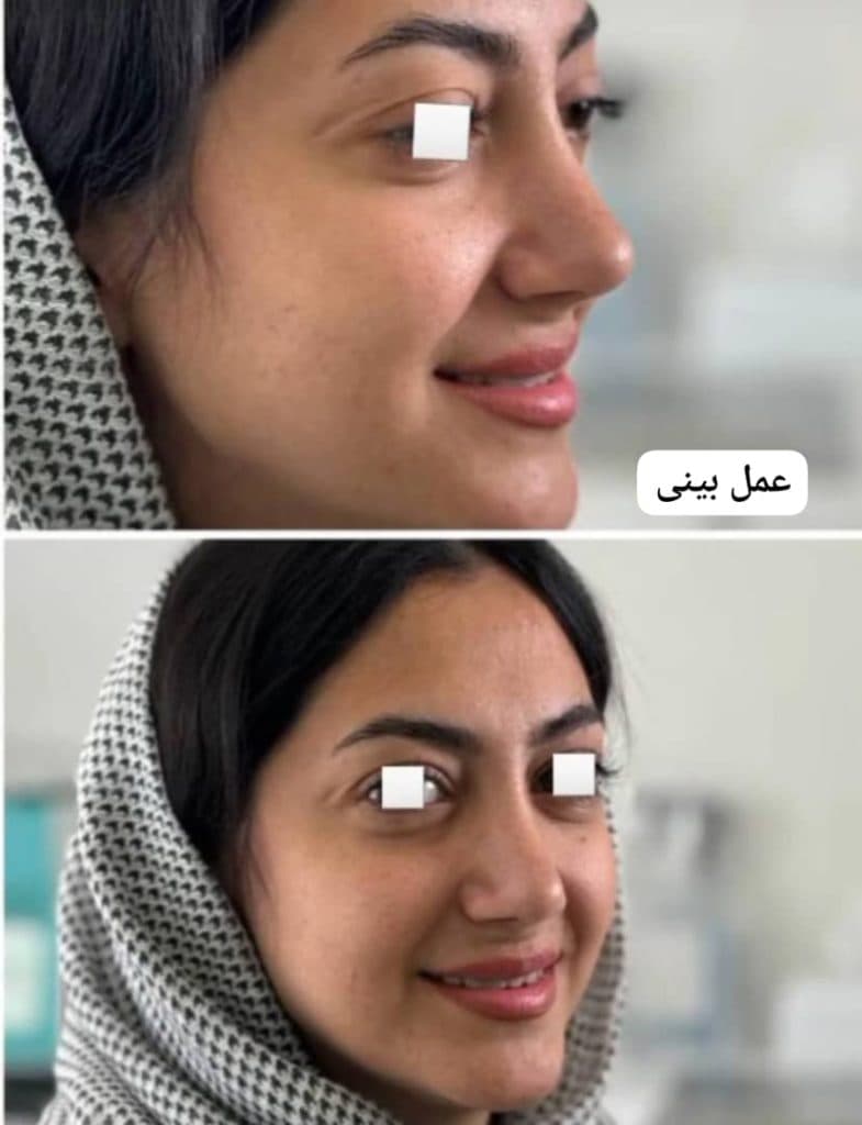 جراحی زیبایی بینی و صورت دکتر سارا ارژنگ در تهران