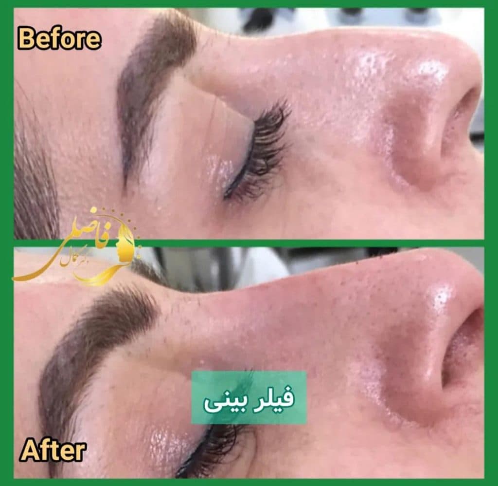 مطب زیبایی دکتر کمال فاضلی در پیروزی تهران