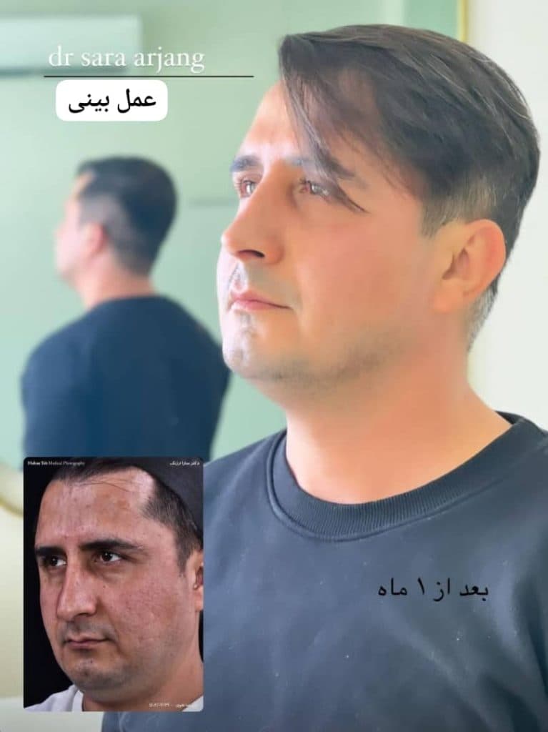 جراحی زیبایی بینی و صورت دکتر سارا ارژنگ در تهران