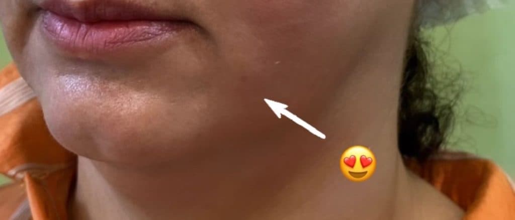 کلینیک زیبایی پوست و مو نهال در تهران