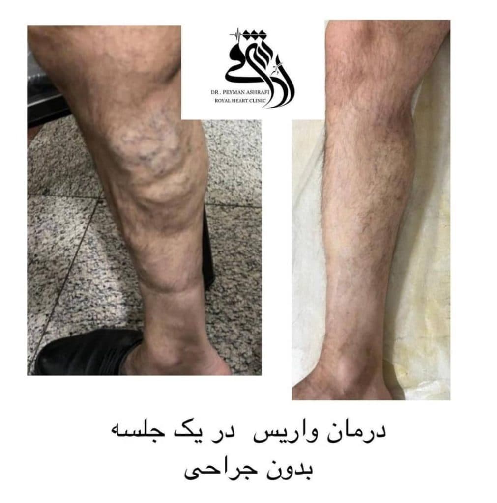 فوق تخصص قلب و عروق دکتر پیمان اشرفی در شرق تهران