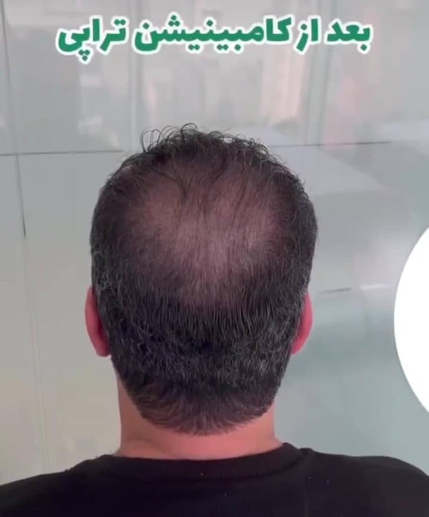 مرکز تخصصی اسکالپ کیان بهبودی در شیراز