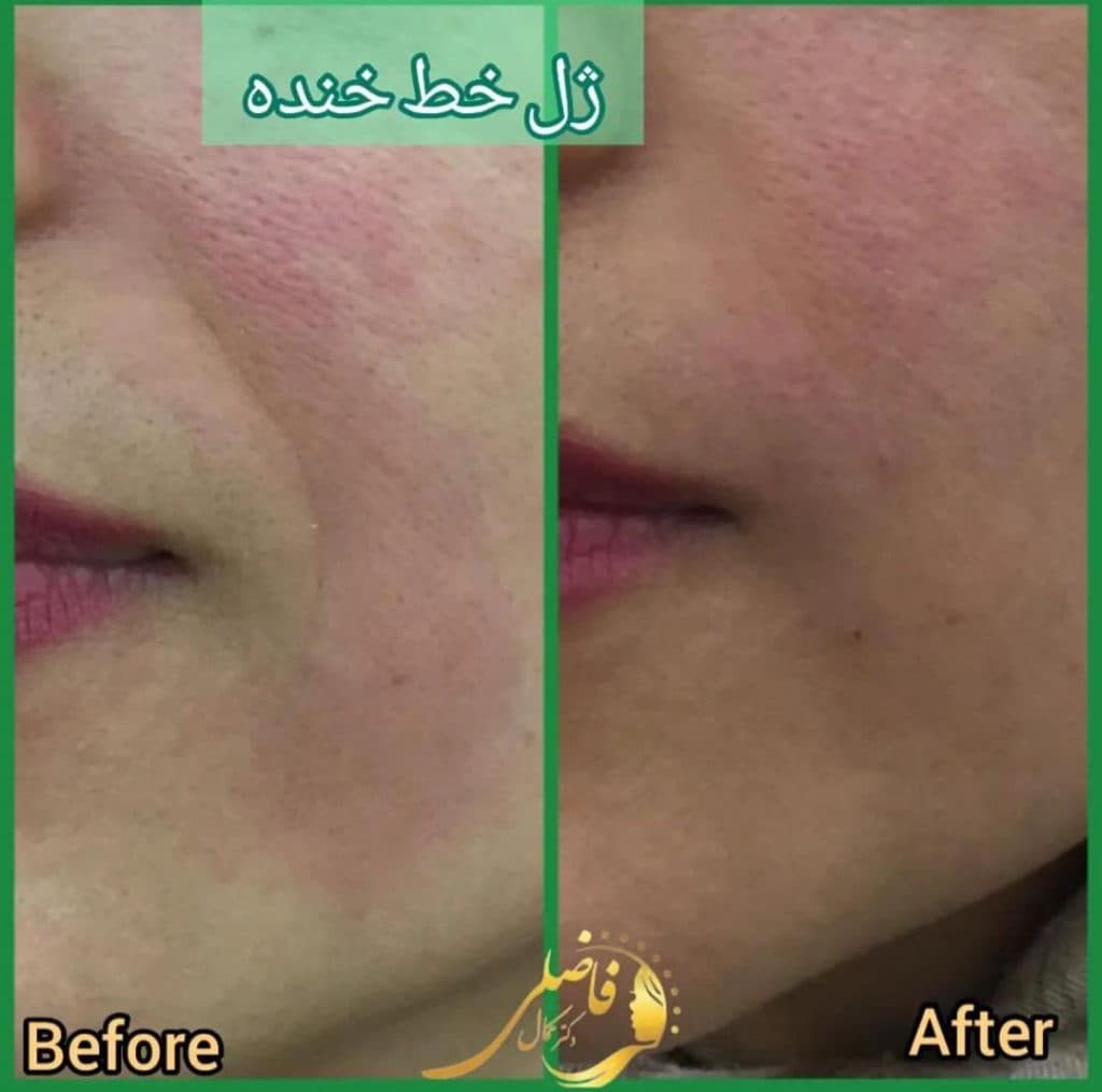 مطب زیبایی دکتر کمال فاضلی در پیروزی تهران