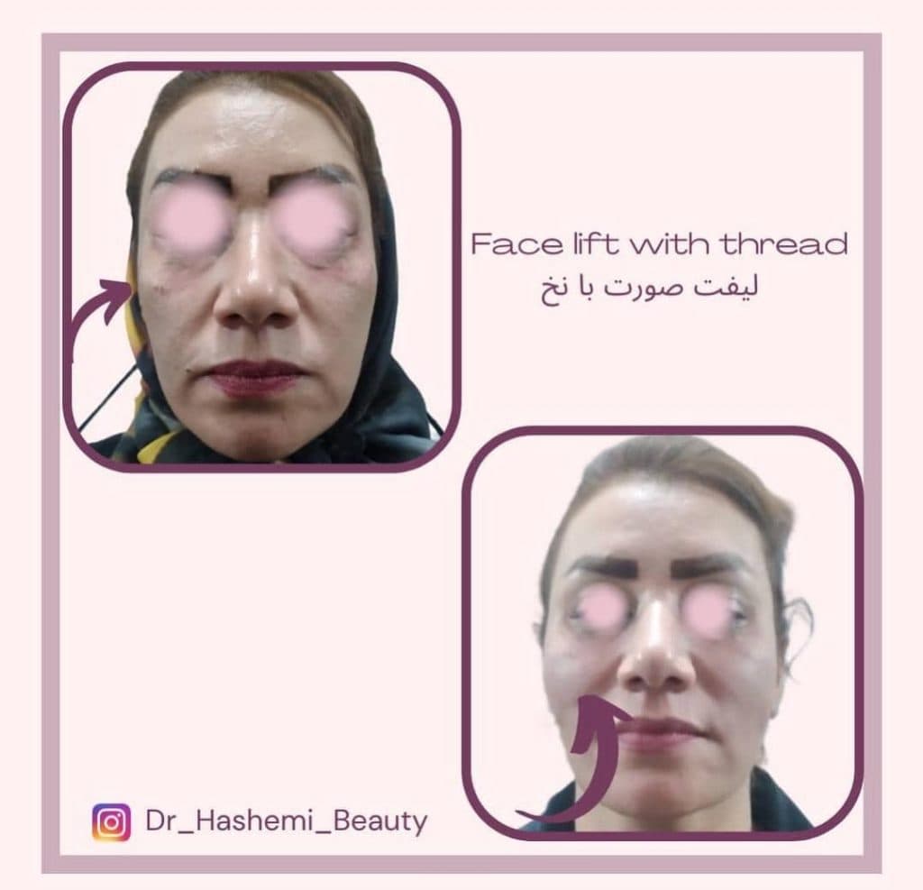 مطب زیبایی پوست و مو دکتر مریم هاشمی عطار در مشهد