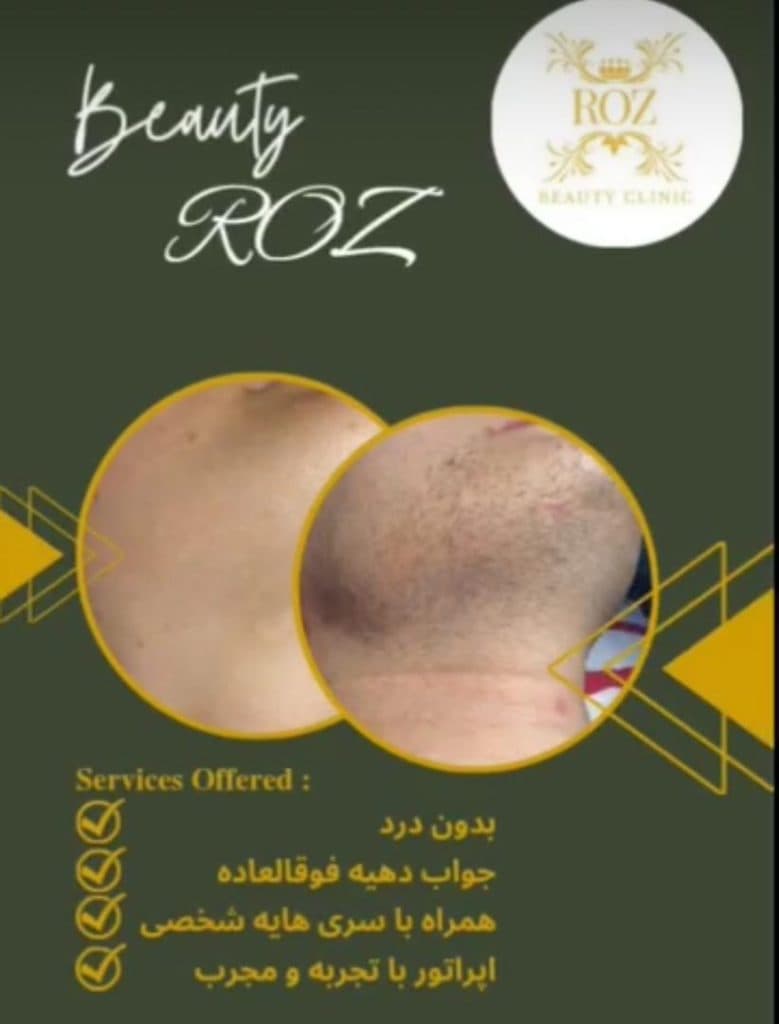 کلینیک تخصصی لیزر رویال در تختی میاندوآب