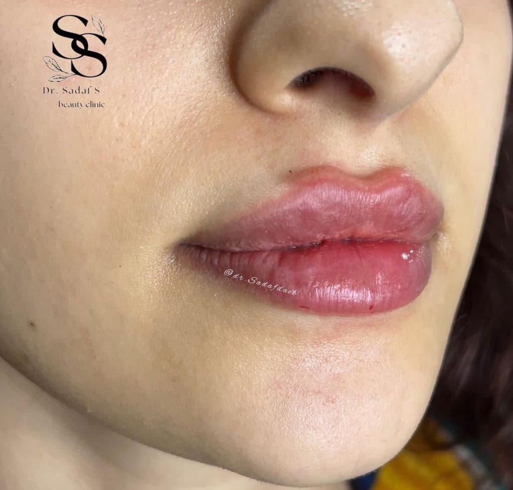 مطب زیبایی دکتر صدف صائب در قدوسی شرقی شیراز