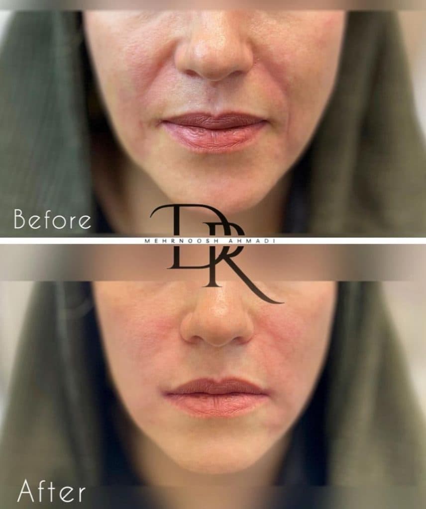 مطب زیبایی مهرنوش احمدی در 24 متری شهریار زنجان