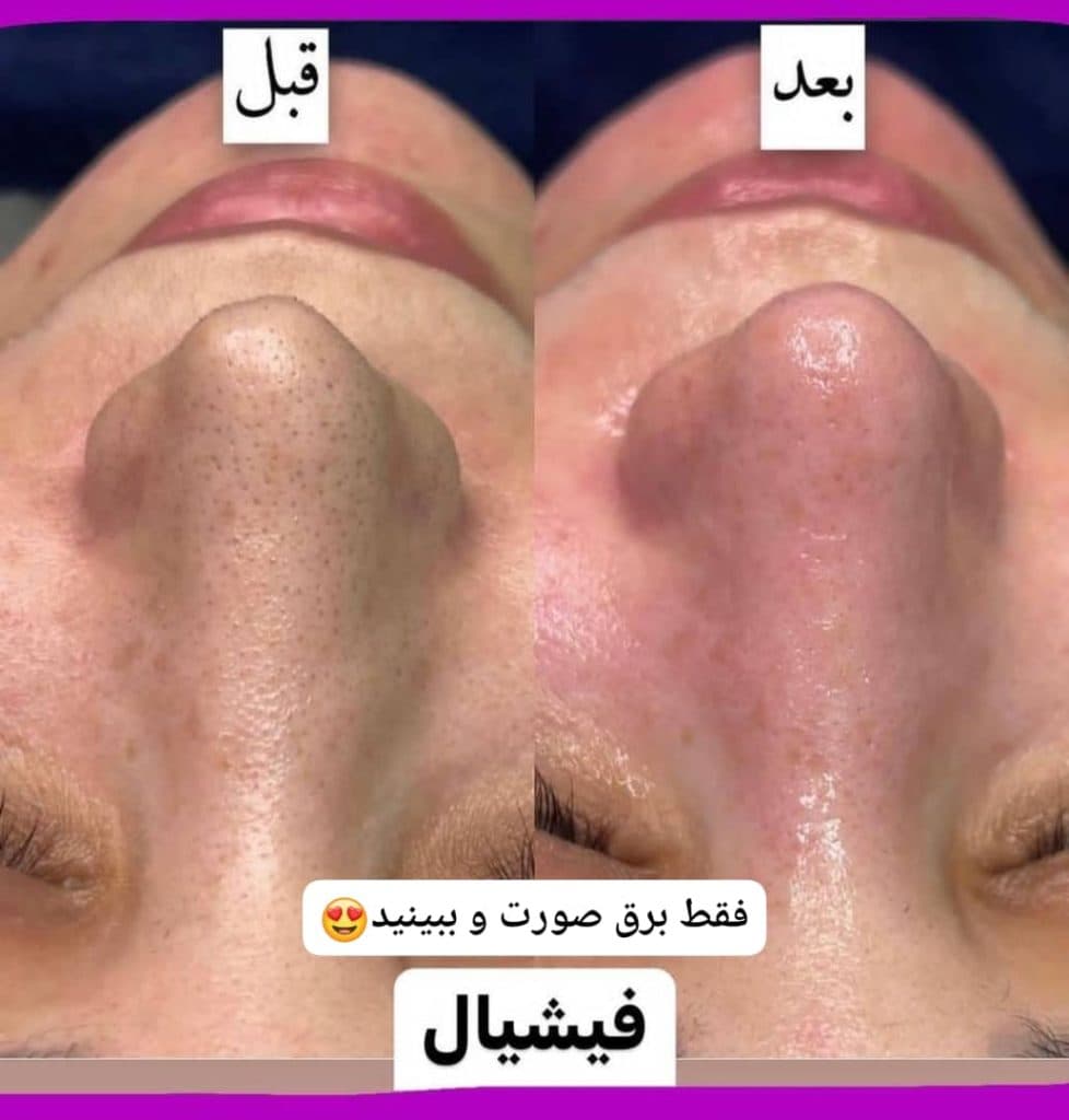 آموزش و خدمات تخصصی پاکسازی پوست لیلا جعفری در صادقیه تهران