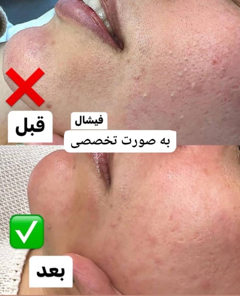 آموزش و خدمات تخصصی پاکسازی پوست لیلا جعفری در صادقیه تهران