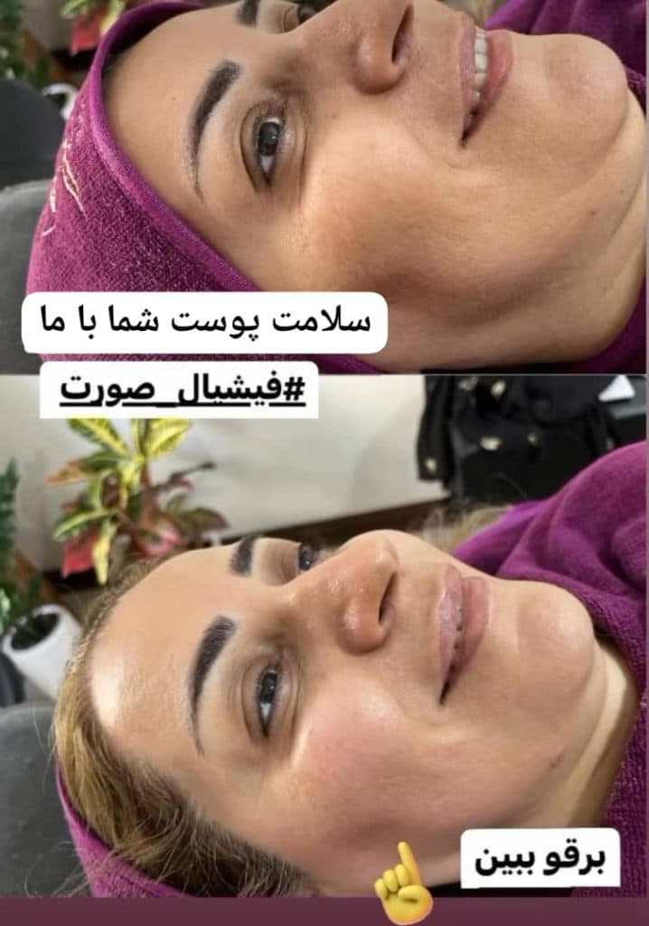 آموزش و خدمات تخصصی پاکسازی پوست لیلا جعفری در صادقیه تهران