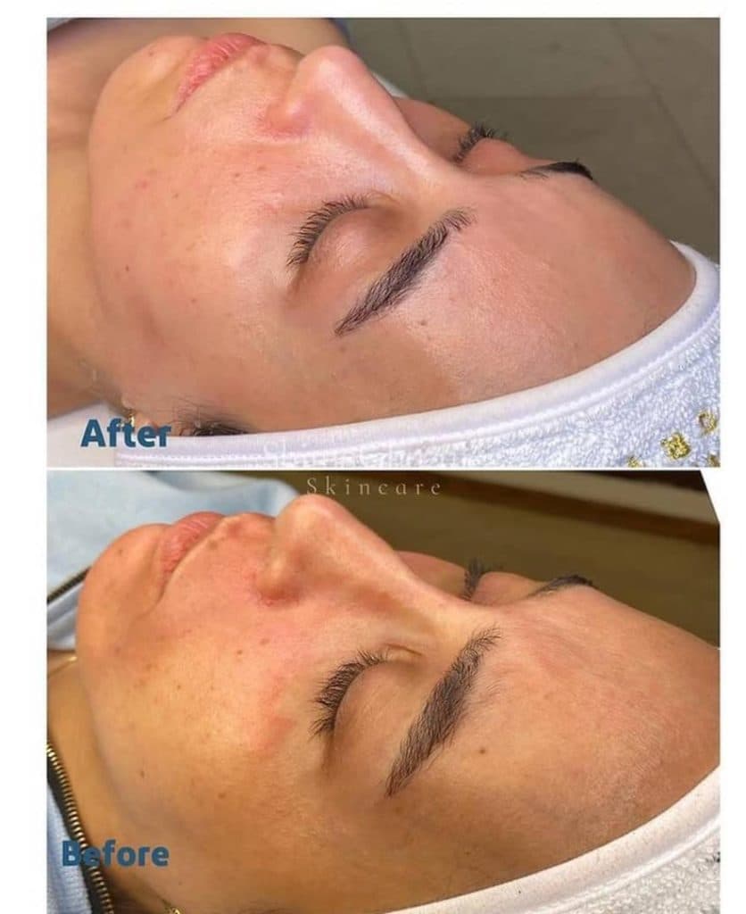 آموزش و خدمات تخصصی پاکسازی پوست شیما قضایی در تهران