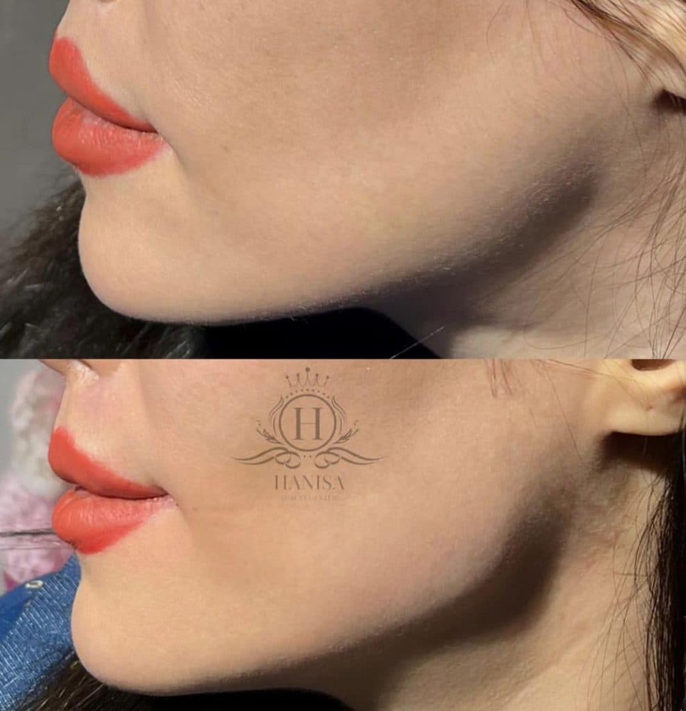 کلینیک زیبایی هانیسا در تهرانپارس تهران