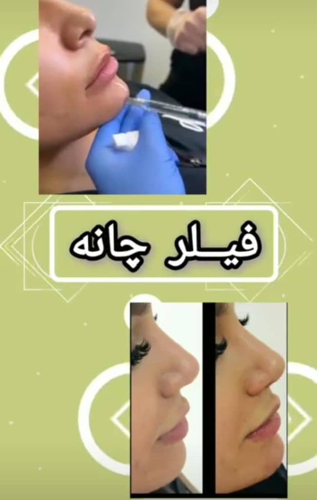 پزشک زیبایی پوست و مو دکتر پرناز حیدری در سلسبیل تهران