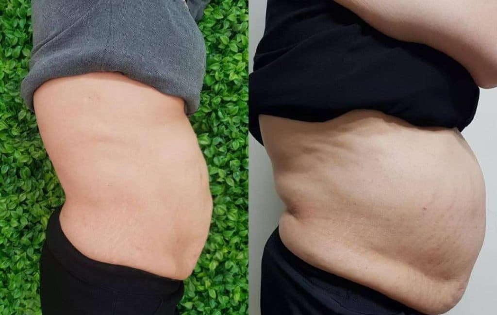 کلینیک تخصصی لاغری و تناسب اندام امولای در بلوار احمدآباد مشهد