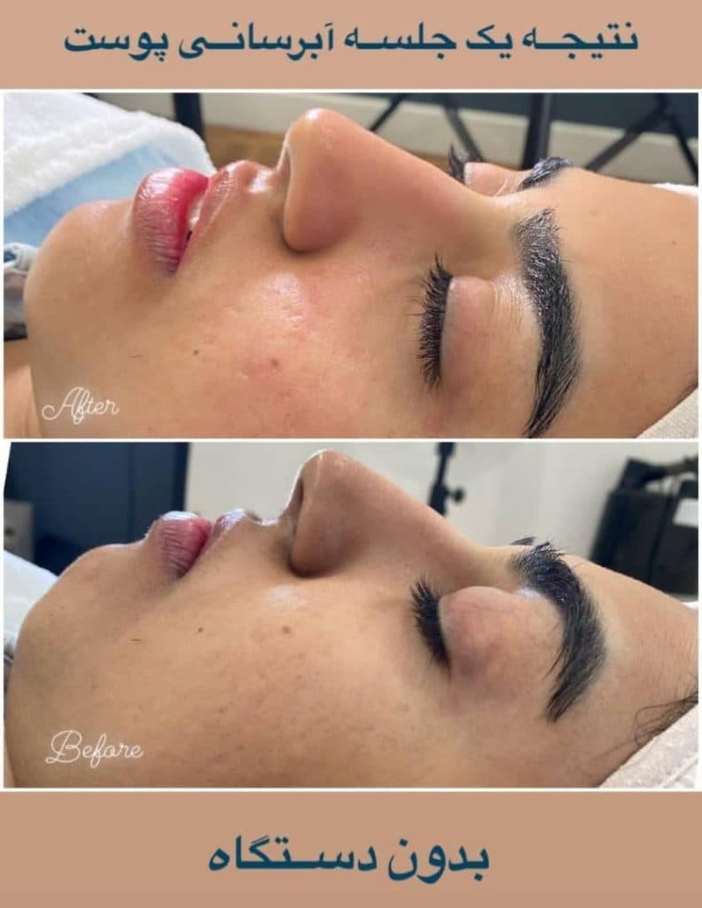 آموزش و خدمات تخصصی پاکسازی پوست شیما قضایی در تهران