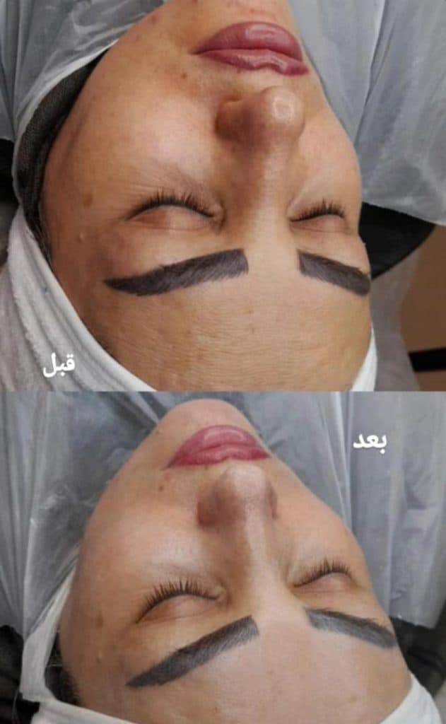 مطب زیبایی مهرنوش احمدی در 24 متری شهریار زنجان