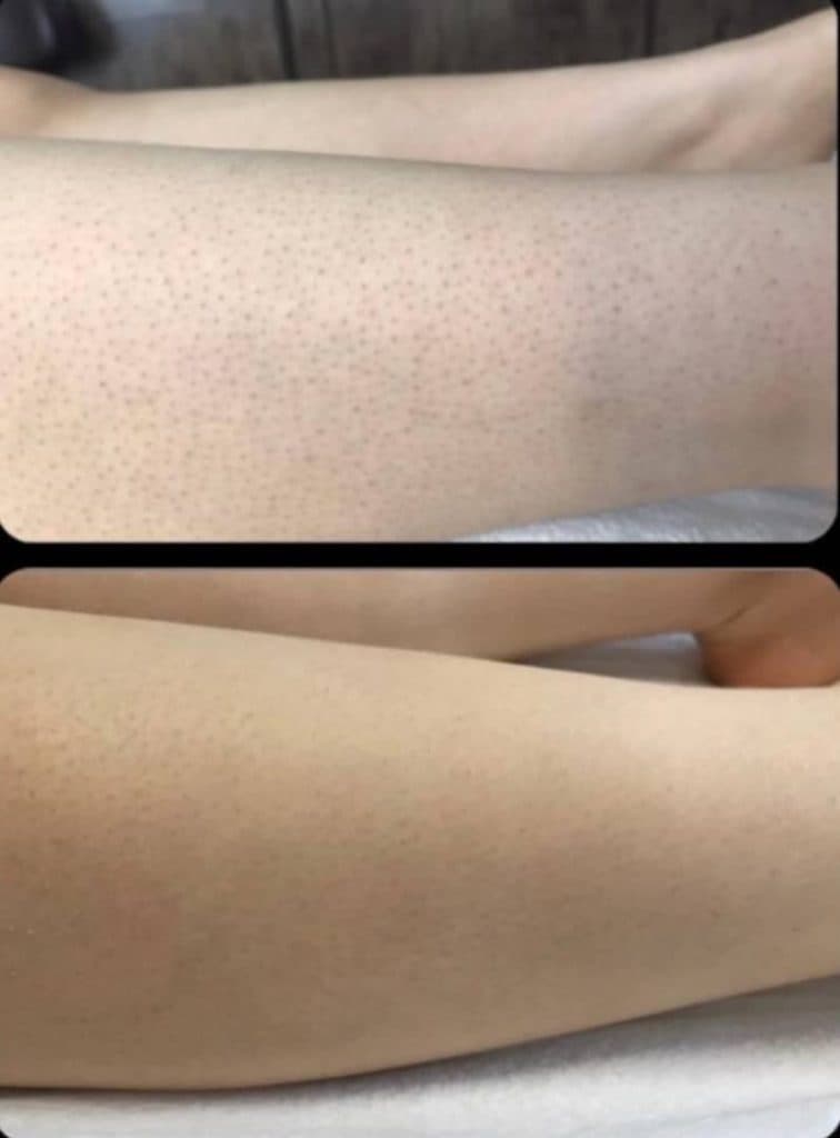 کلینیک زیبایی دلارز در گلشهر کرج