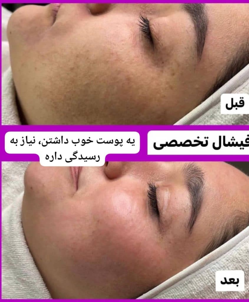 آموزش و خدمات تخصصی پاکسازی پوست لیلا جعفری در صادقیه تهران