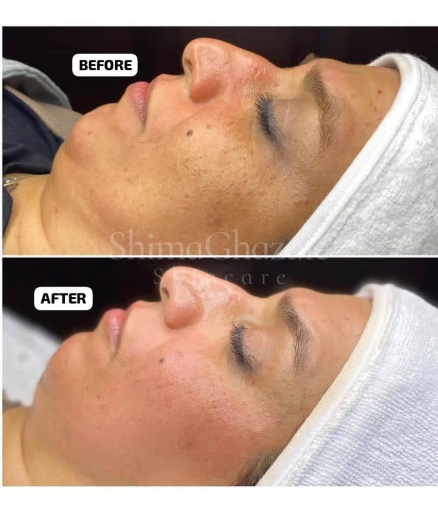 آموزش و خدمات تخصصی پاکسازی پوست شیما قضایی در تهران
