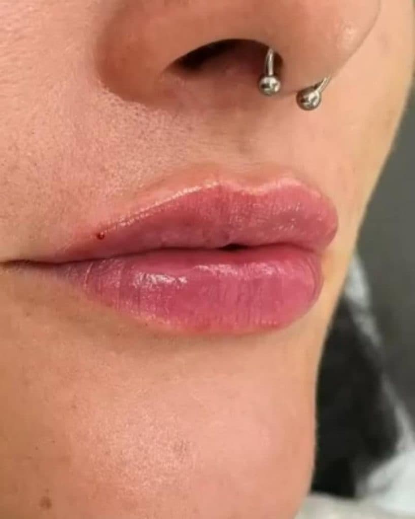 پزشک زیبایی پوست و مو دکتر پرناز حیدری در سلسبیل تهران