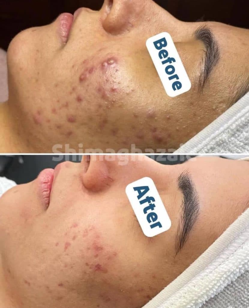 آموزش و خدمات تخصصی پاکسازی پوست شیما قضایی در تهران