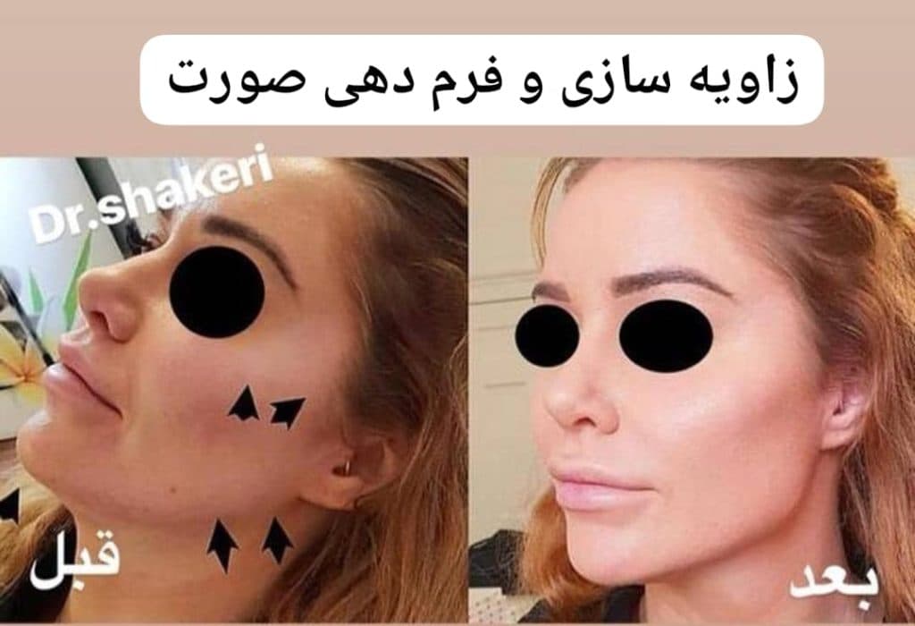 کلینیک زیبایی پوست و مو دکتر محمدعلی شاکری در تهران