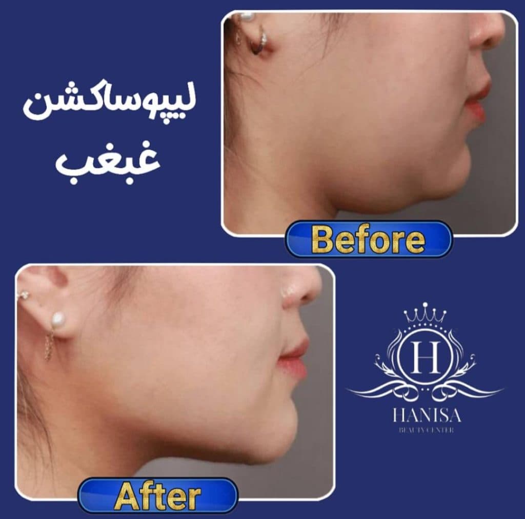 کلینیک زیبایی هانیسا در تهرانپارس تهران