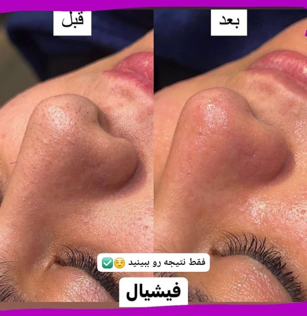 آموزش و خدمات تخصصی پاکسازی پوست لیلا جعفری در صادقیه تهران
