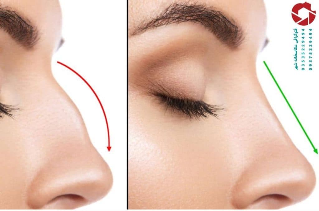 عکاسی جراحی عکاسخانه شهر خالصی زاده در سه راه شحنه یزد