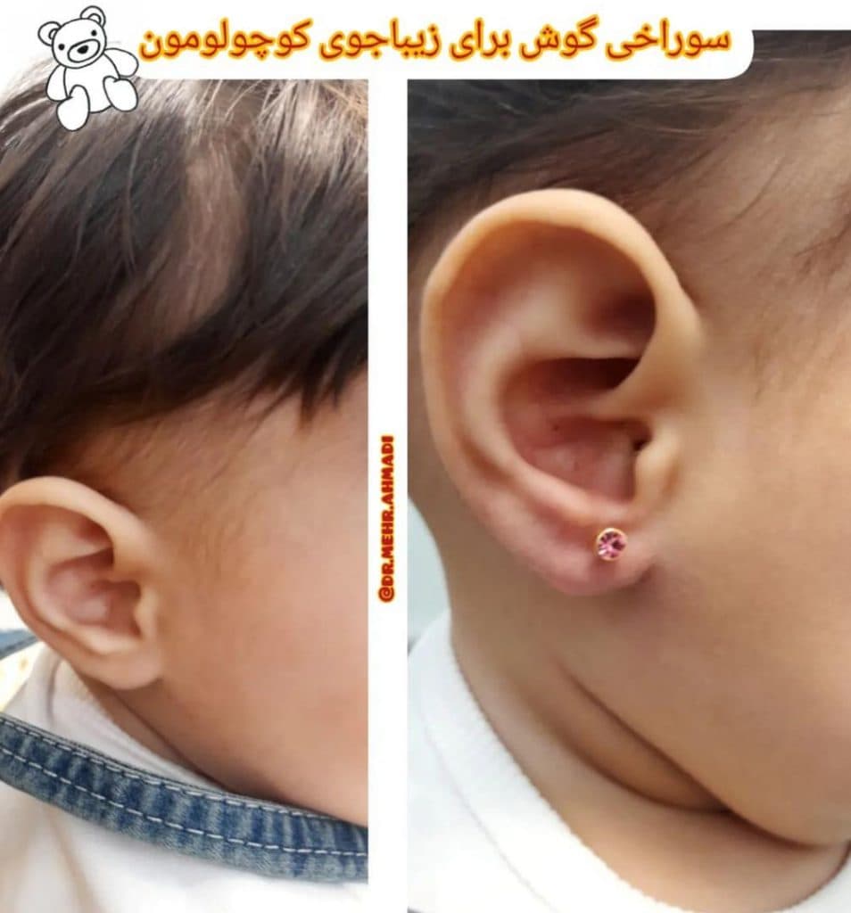 مطب زیبایی مهرنوش احمدی در 24 متری شهریار زنجان
