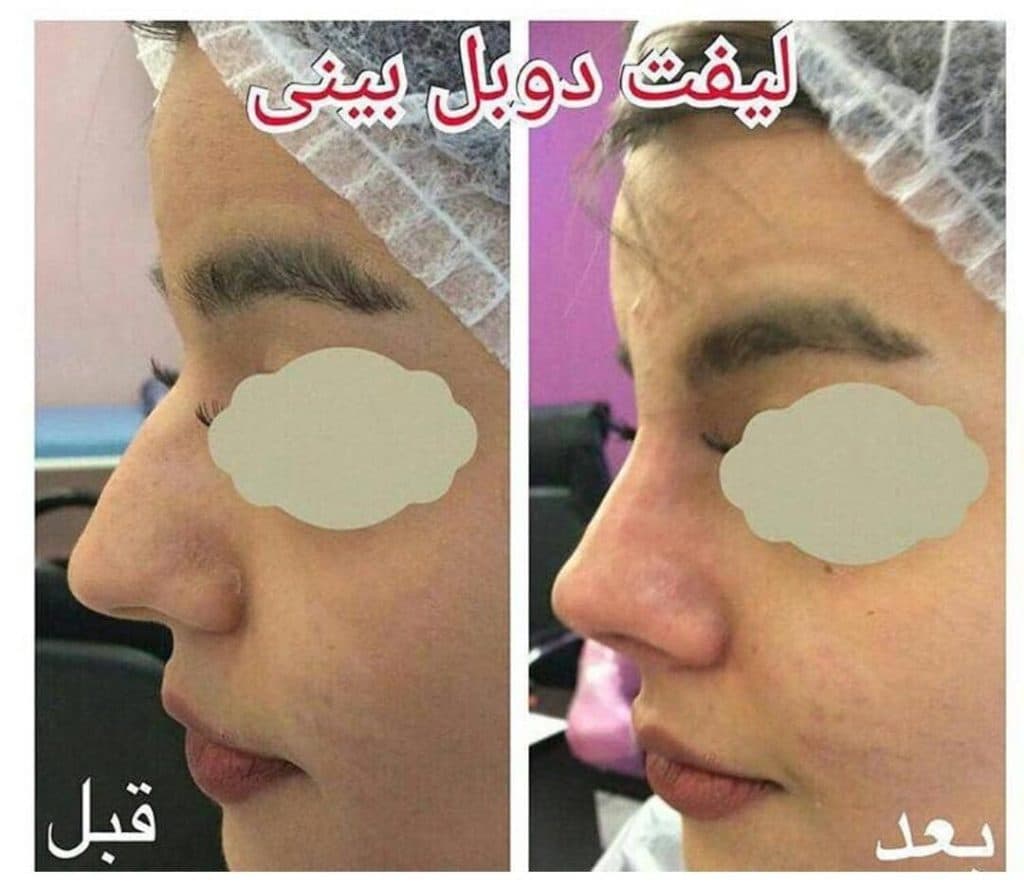 کلینیک زیبایی پوست و مو دکتر محمدعلی شاکری در تهران