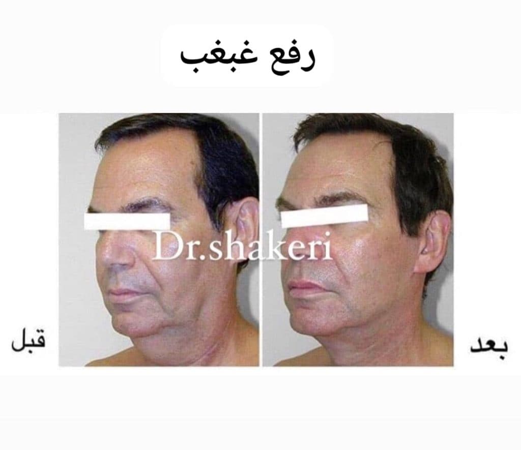 کلینیک زیبایی پوست و مو دکتر محمدعلی شاکری در تهران