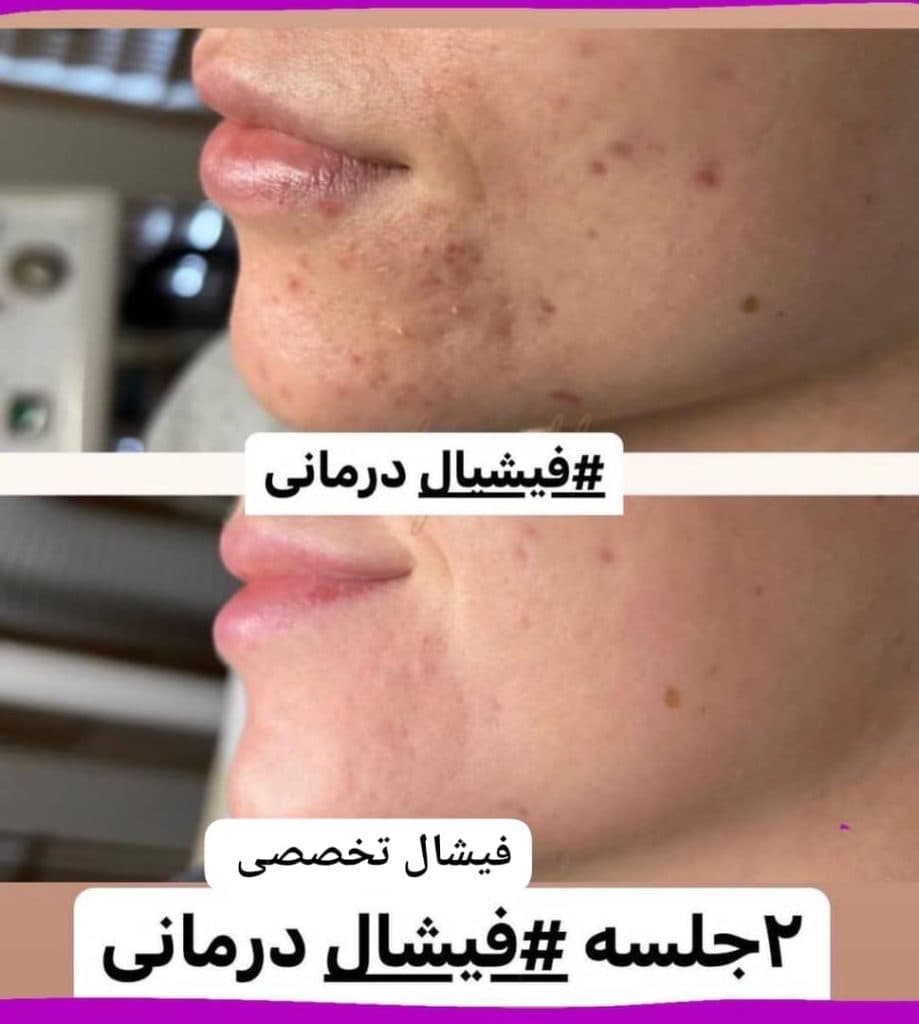 آموزش و خدمات تخصصی پاکسازی پوست لیلا جعفری در صادقیه تهران