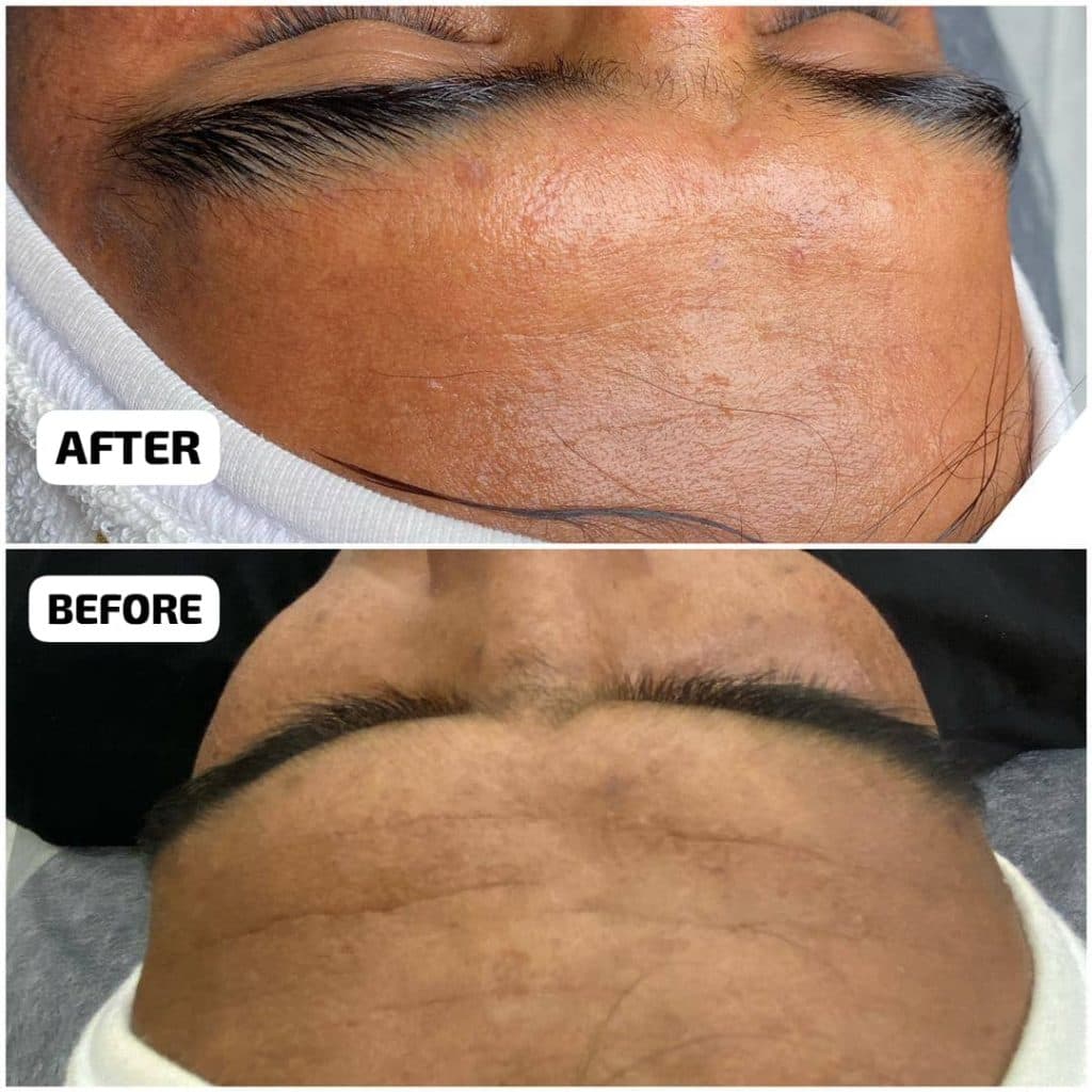 آموزش و خدمات تخصصی پاکسازی پوست شیما قضایی در تهران