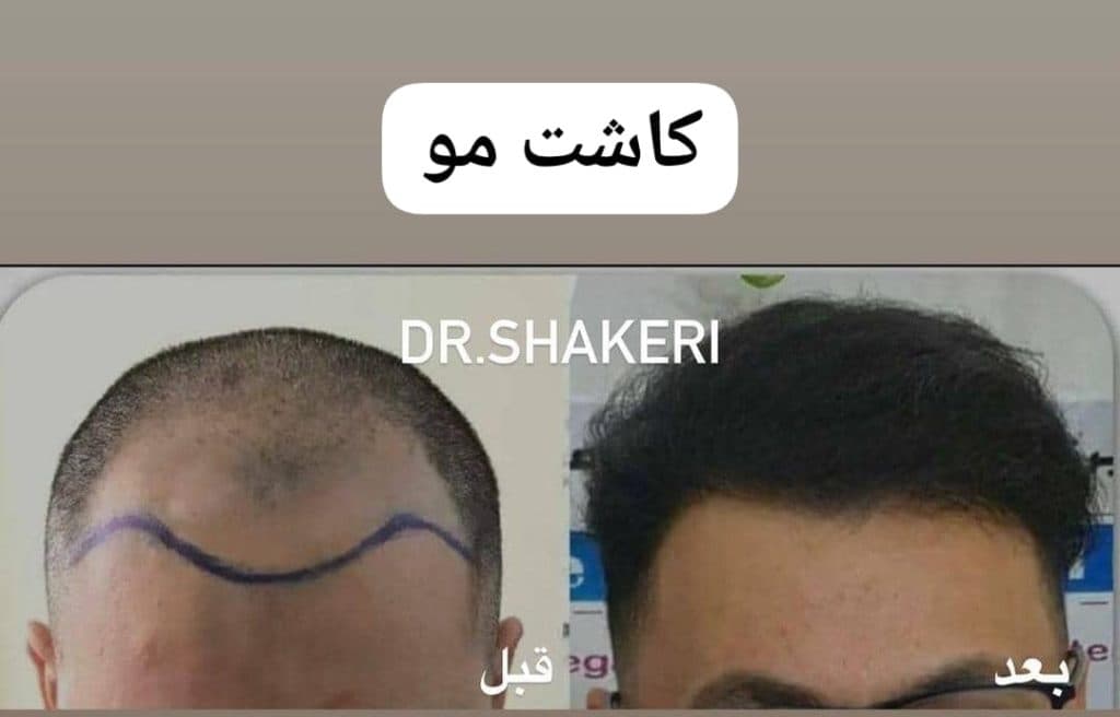 کلینیک زیبایی پوست و مو دکتر محمدعلی شاکری در تهران