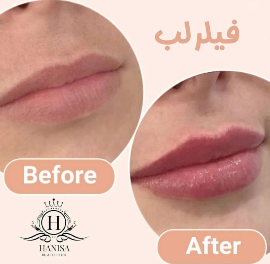 کلینیک زیبایی هانیسا در تهرانپارس تهران