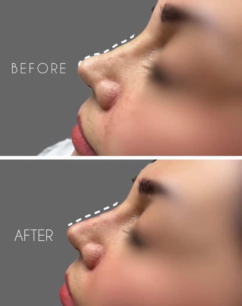 مطب زیبایی مهرنوش احمدی در 24 متری شهریار زنجان