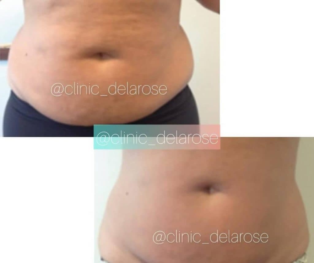 کلینیک زیبایی دلارز در گلشهر کرج