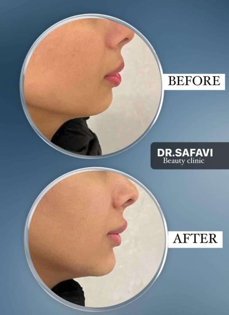 کلینیک زیبایی دکتر صفوی در قصرالدشت شیراز