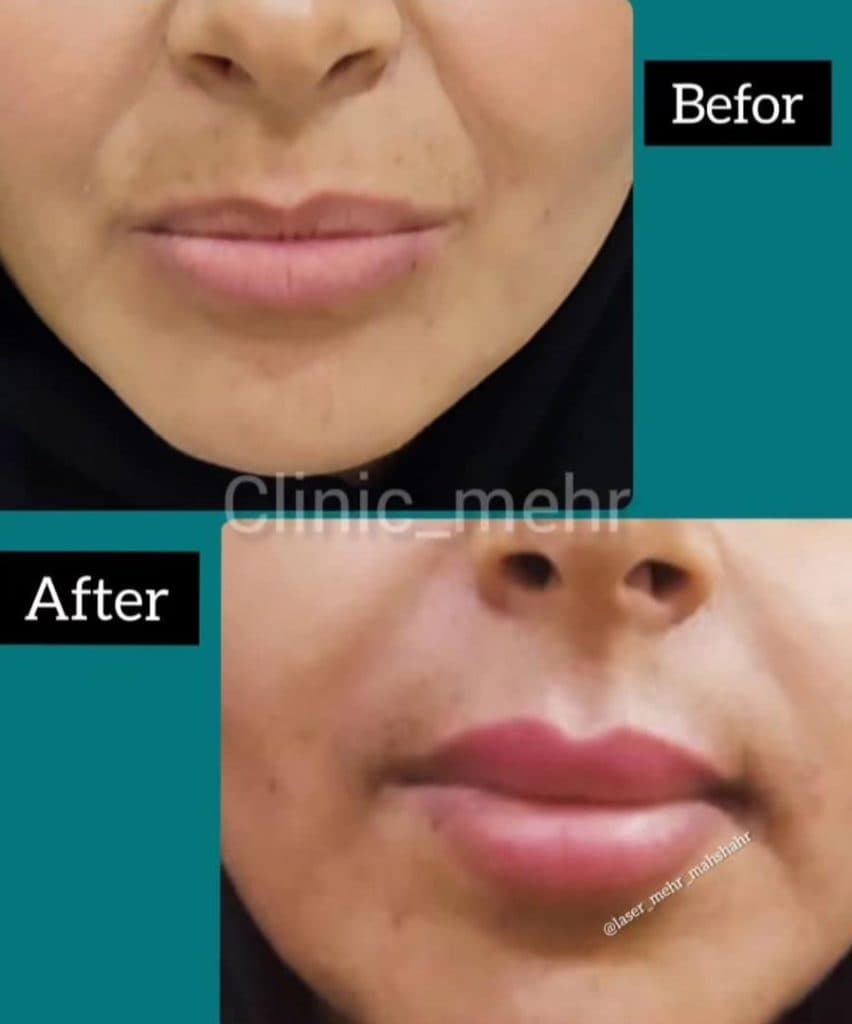 کلینیک تخصصی زیبایی مهر در میدان امام بندرماهشهر