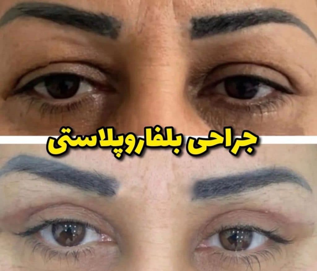 کلینیک تخصصی لاغری و تناسب اندام امولای در بلوار احمدآباد مشهد