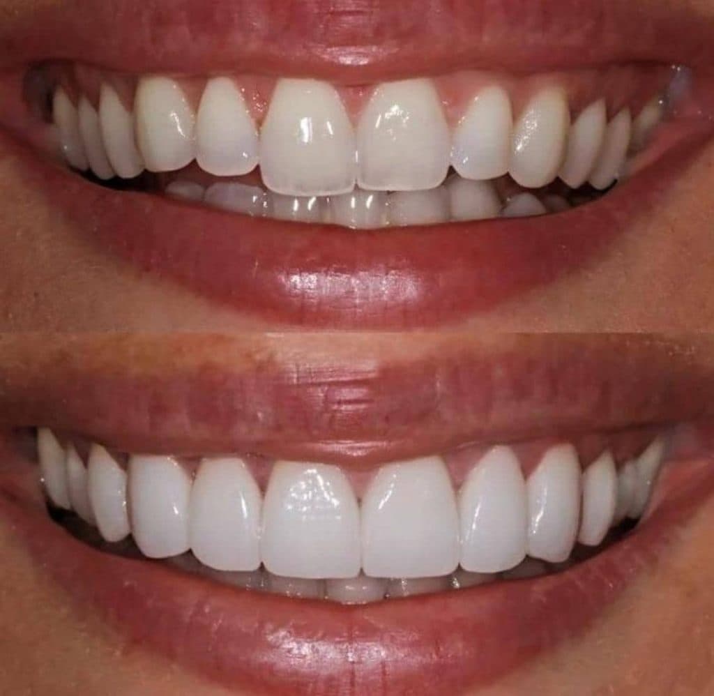 مطب دندانپزشکی و ایمپلنت دکتر رضا شکیبایی در سلسبیل تهران